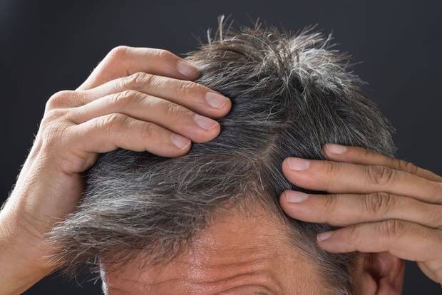  آیا استرس موجب سفید شدن مو می‌شود؟