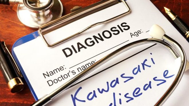 کاوازاکی کیست؟ کاوازاکی چیست؟ چرا نامش سر زبان‌ها افتاده؟